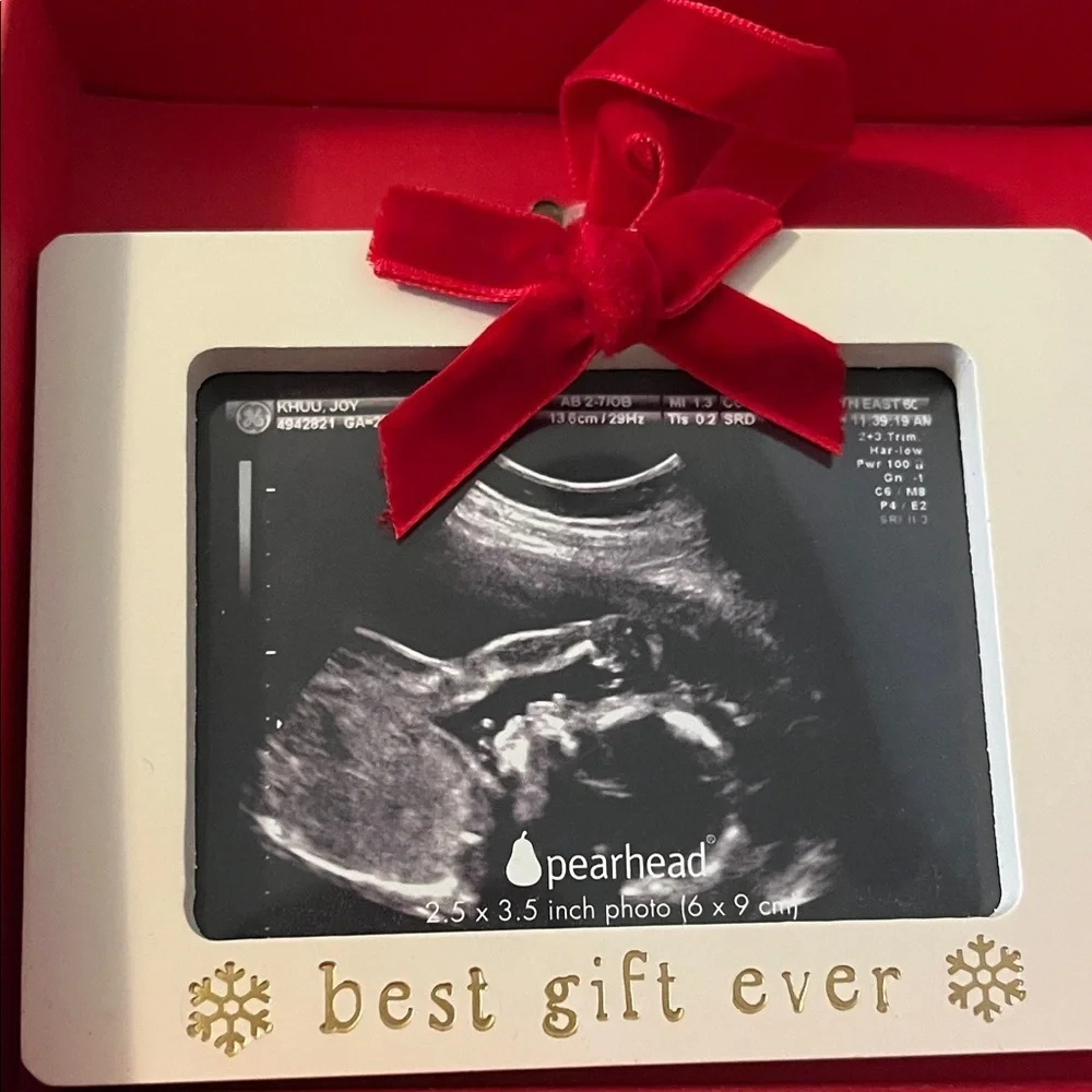 Sonogram Ornament - Red and White